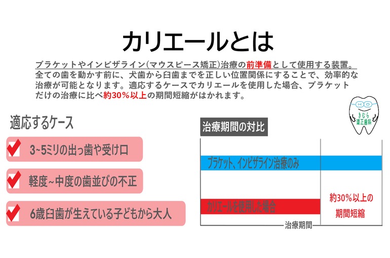 カリエール説明